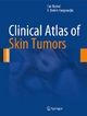 Clinical Atlas of Skin Tumors - Can Baykal; K. Didem Yazganoğ