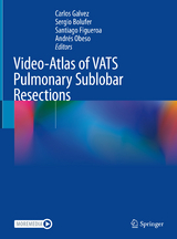Video-Atlas of VATS Pulmonary Sublobar Resections - 