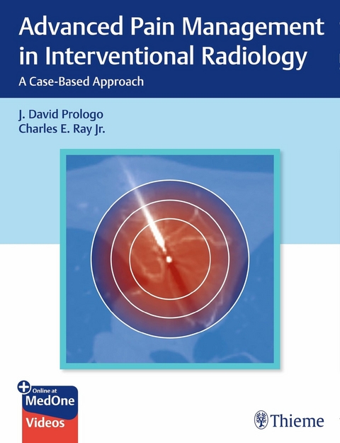 Advanced Pain Management in Interventional Radiology - 