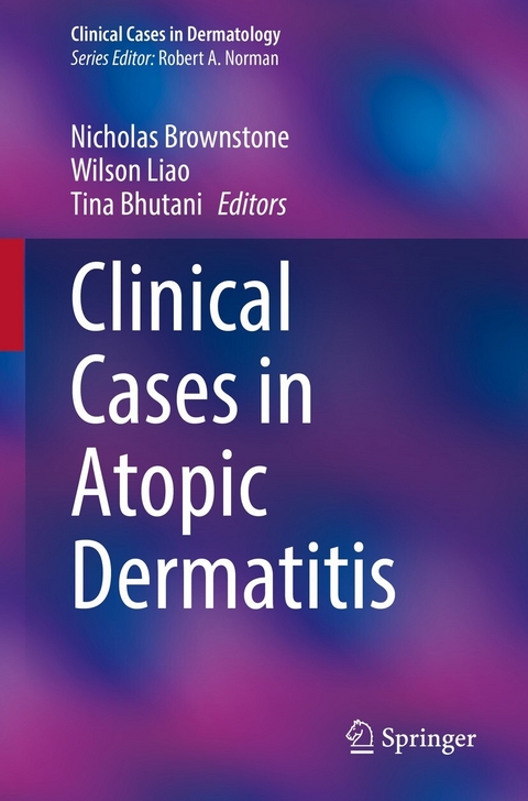 Clinical Cases in Atopic Dermatitis - 