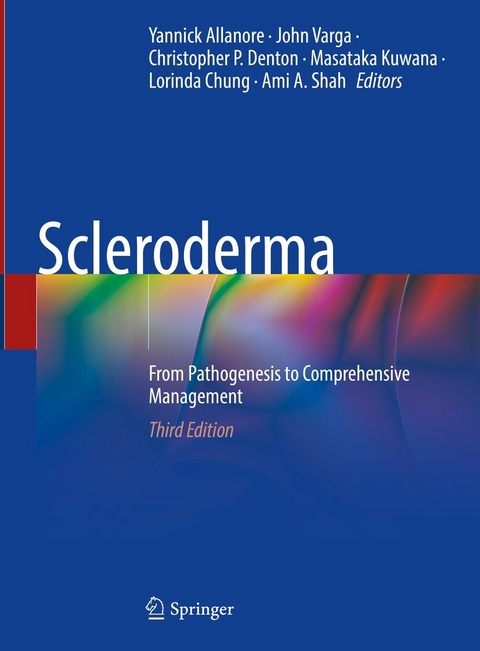 Scleroderma - 