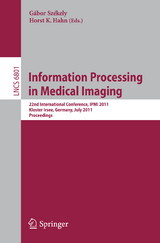 Information Processing in Medical Imaging - 
