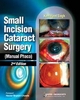 Small Incision Cataract Surgery - Manual Phaco - Kamaljeet Singh
