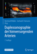 Duplexsonographie der hirnversorgenden Arterien - Bernhard Widder, Gerhard F. Hamann