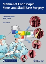 Manual of Endoscopic Sinus and Skull Base Surgery - Daniel Simmen, Nick Jones