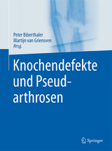 Knochendefekte und Pseudarthrosen - Peter Biberthaler, Martijn Griensven, Patrick Delhey