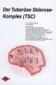 Der Tuberöse Sklerose-Komplex (TSC) (UNI-MED Science)