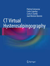 CT Virtual Hysterosalpingography - Patricia Carrascosa, Carlos Capuñay, Carlos E. Sueldo, Juan Mariano Baronio