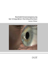 Kontaktlinsenanpassung bei irregulären Hornhautformen - Gustav Pöltner