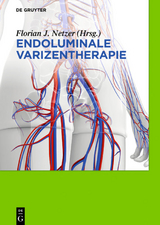 Endoluminale Varizentherapie - Florian Johannes Netzer
