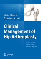 Clinical Management of Hip Arthroplasty - Hartmuth Kiefer