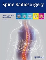 Spine Radiosurgery - Gerszten, Peter; Ryu, Samuel