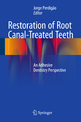 Restoration of Root Canal-Treated Teeth - 