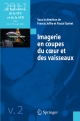Imagerie en coupes du cœur et des vaissea - Francis Joffre;  Pascal Guéret