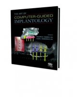 The Art of Computer-guided Implantology - Philippe Tardieu, Alan Rosenfield