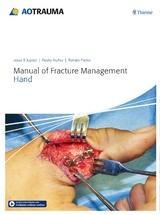 Manual of Fracture Management - Hand - 