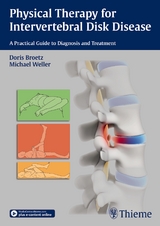 Physical Therapy for Intervertebral Disk Disease - Doris Brötz, Michael Weller