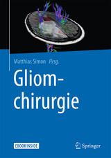 Gliomchirurgie - 