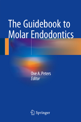 The Guidebook to Molar Endodontics - 