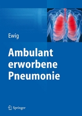 Ambulant erworbene Pneumonie - 