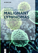 Malignant Lymphomas - 