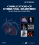 Complications of Myocardial Infarction E-Book - Stuart J. Hutchison