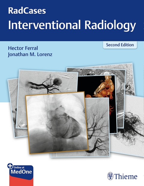 Radcases Interventional Radiology - Hector Ferral, Jonathan M. Lorenz