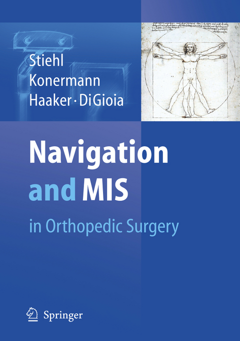 Navigation and MIS in Orthopedic Surgery - 