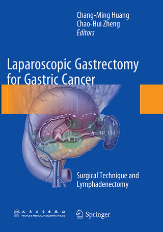 Laparoscopic Gastrectomy for Gastric Cancer - Chang-ming Huang; Chao-Hui Zheng