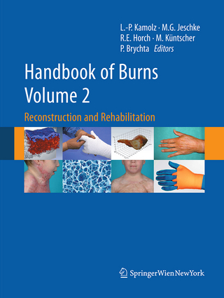 Handbook of Burns Volume 2 - Lars-Peter Kamolz; Marc G. Jeschke; Raymund E. Horch; Markus Küntscher; Pavel Brychta