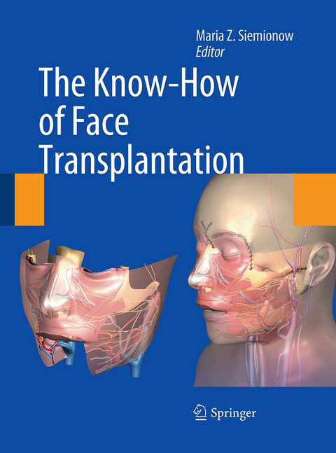 The Know-How of Face Transplantation - 