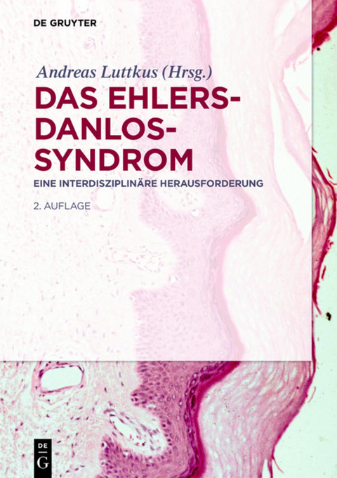 Das Ehlers-Danlos-Syndrom - 