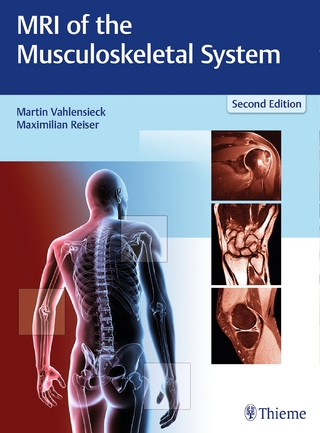 MRI of the Musculoskeletal System - Martin Vahlensieck; Maximilian Reiser