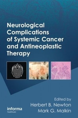Neurological Complications of Systemic Cancer and Antineoplastic Therapy (Neurological Disease and Therapy, Band 96)