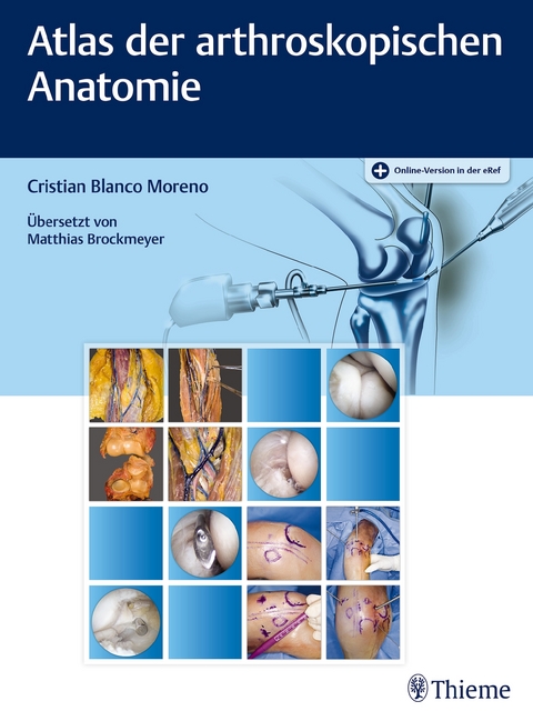 Atlas der arthroskopischen Anatomie - Cristian Blanco Moreno