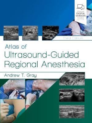 Atlas of Ultrasound-Guided Regional Anesthesia - Andrew T. Gray