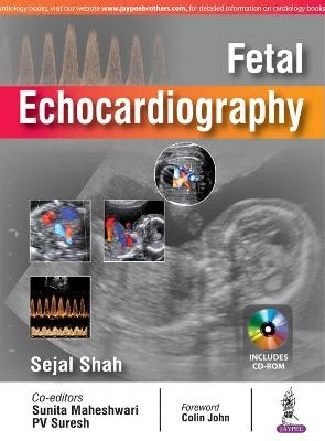 Fetal Echocardiography - Sejal Shah, Sunita Maheshwari,  "Suresh"