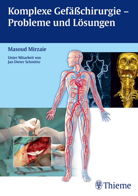 Komplexe Gefäßchirurgie - Probleme und Lösungen - Masoud Mirzaie