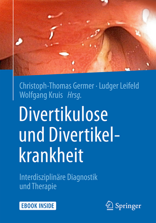 Divertikulose und Divertikelkrankheit - Christoph-Thomas Germer; Ludger Leifeld; Wolfgang Kruis