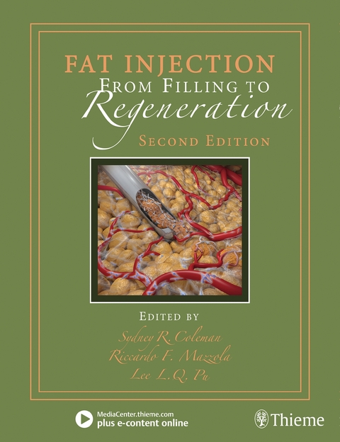 Fat Injection - 