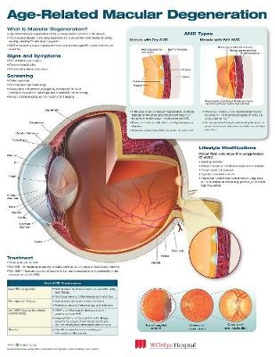 Age-Related Macular Degeneration Anatomical Chart