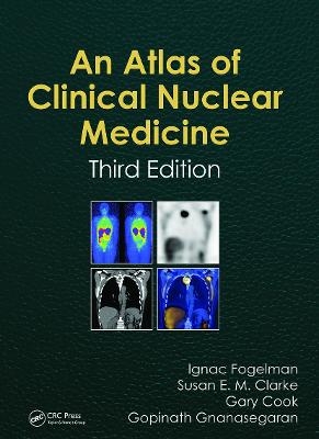 Atlas of Clinical Nuclear Medicine - Ignac Fogelman; Susan Clarke; Gary Cook; Gopinath Gnanasegaran