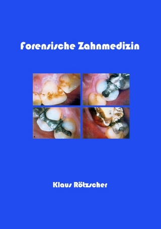Forensische Zahnmedizin - Klaus Rötzscher
