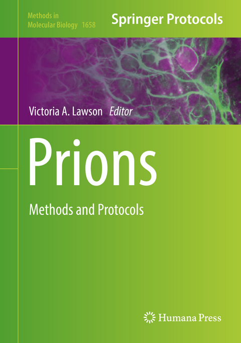 Prions - 