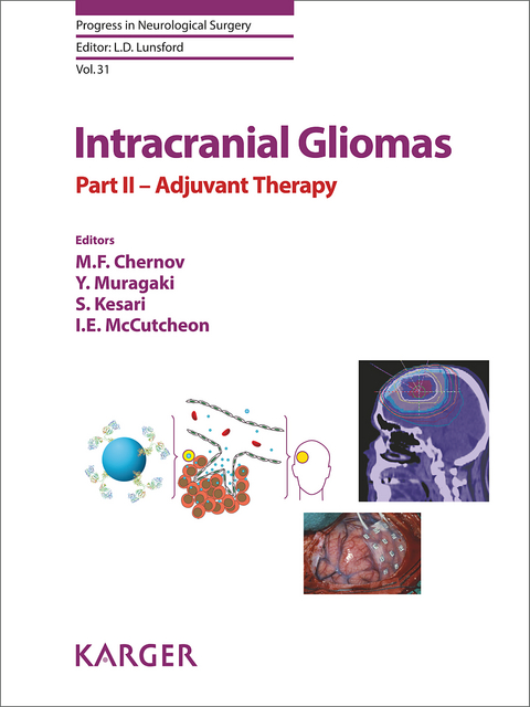 Intracranial Gliomas Part II - Adjuvant Therapy - 