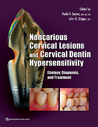 Noncarious Cervical Lesions and Cervical Dentin Hypersensitivity - 
