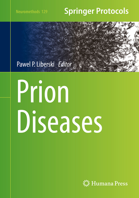 Prion Diseases - 