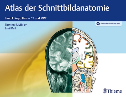 Atlas der Schnittbildanatomie, Band 1: Kopf, Hals - Torsten Bert Möller, Emil Reif