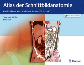 Atlas der Schnittbildanatomie, Band 2: Thorax, Herz, Abdomen, Becken - Torsten Bert Möller; Emil Reif