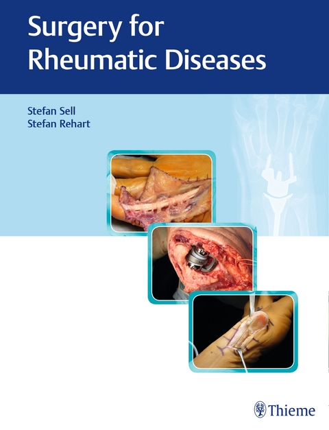 Surgery for Rheumatic Diseases - Stefan Sell, Stefan Rehart